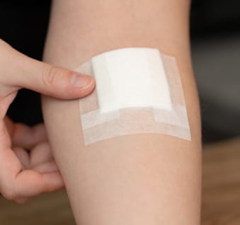 Brazo con apósito colocado con micropore blanco.